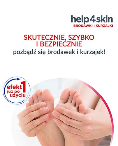 Help4skin brodawki i kurzajki 50 ml